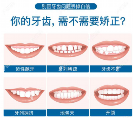 做活动假牙需要动边牙吗,活动假牙需要多长时间适应？相关知识！